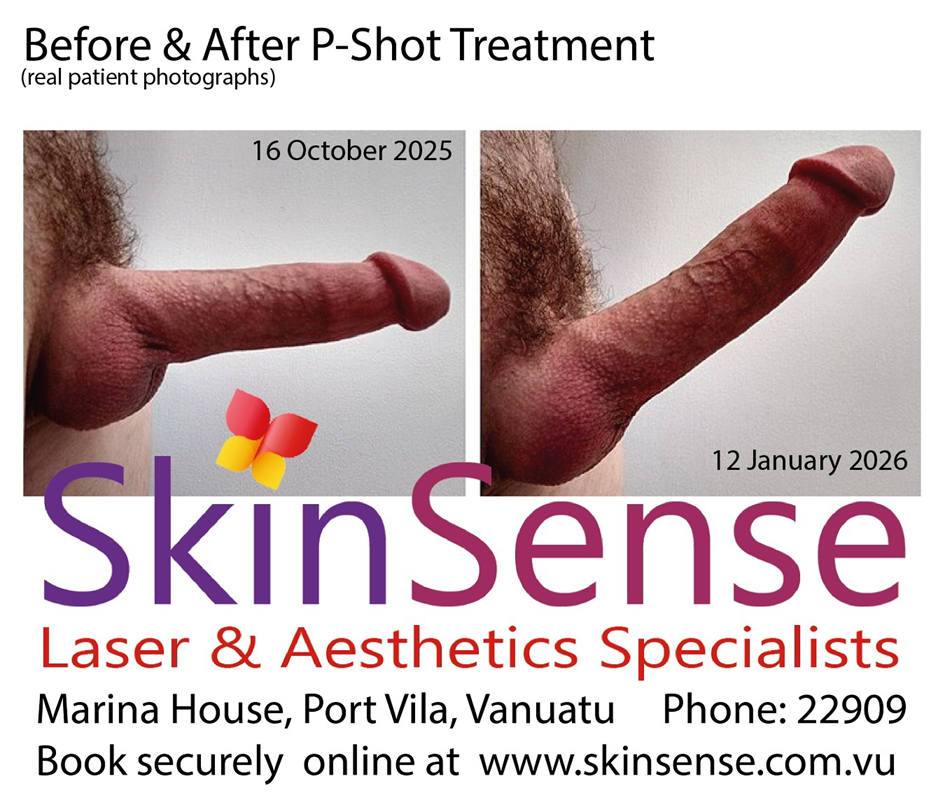 P.Shot before and after pictures.